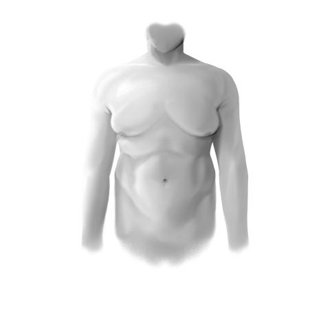 Gynecomastia Surgery Before