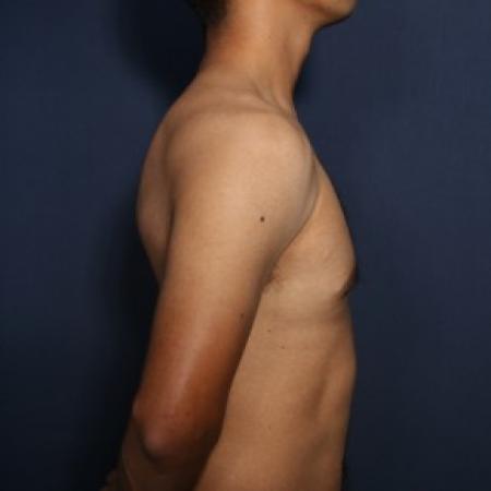 After image 2 Case #83856 - 30 Years Old Male 