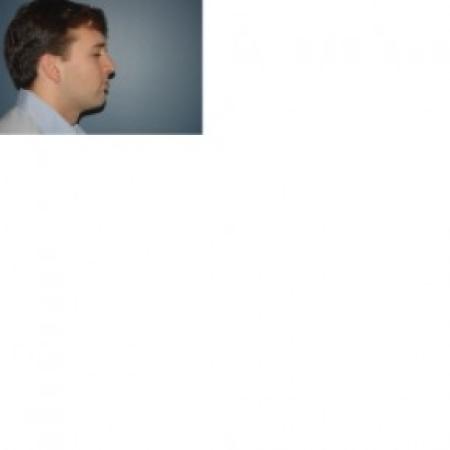 After image 2 Case #81261 - Rhinoplasty