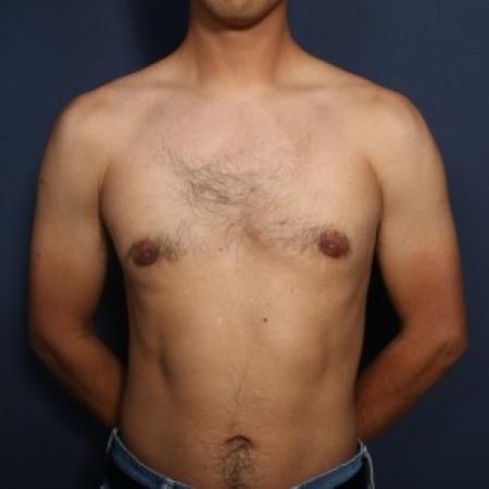 After image 1 Case #83856 - 30 Years Old Male 
