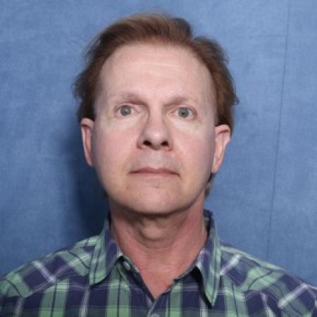 After image 1 Case #83681 - 63 Year Old Male