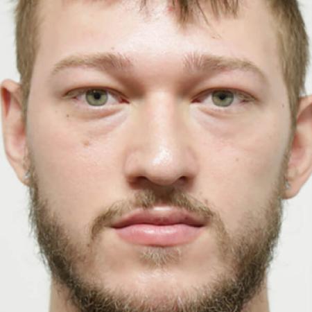 Before image 1 Case #106486 - Male Face Transformation