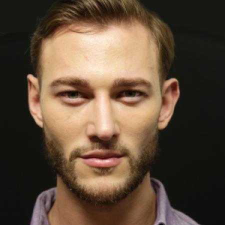 After image 1 Case #106486 - Male Face Transformation