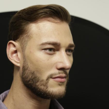 After image 2 Case #106486 - Male Face Transformation