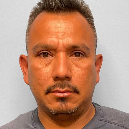 After image 1 Case #115701 - Upper & Lower Blepharoplasty