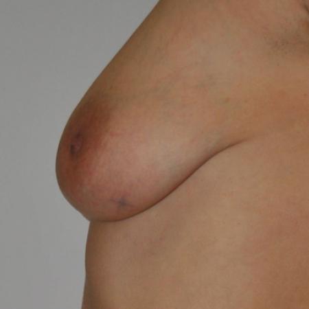 Before image 4 Case #122856 - AUTOAUGMENTATION