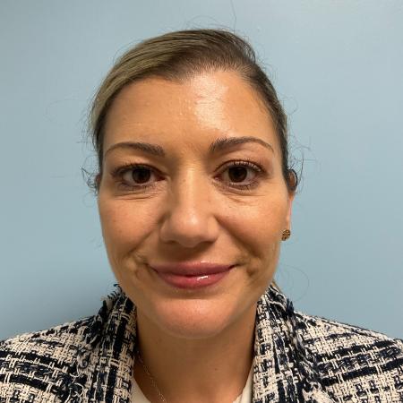 After image 1 Case #123376 - 44 year old female with Botox injections & Filler