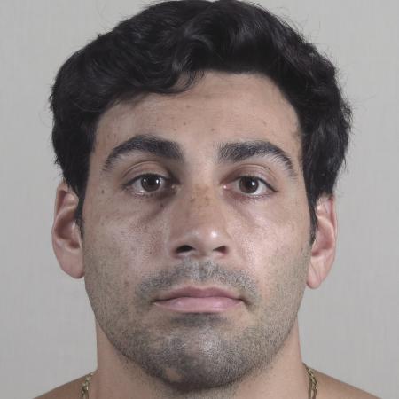 After image 1 Case #124576 - Rhinoplasty Patient #1433