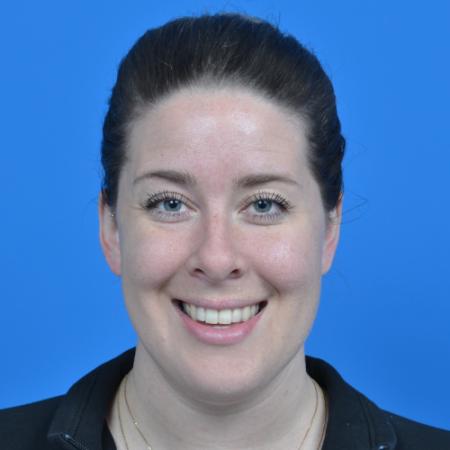 After image 1 Case #126576 - otoplasty 31 year old woman