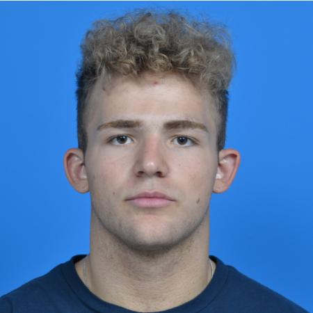 Before image 1 Case #126566 - Otoplasty 19 year old