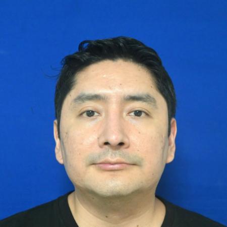 After image 1 Case #127141 - Case 6 - Rhinoplasty