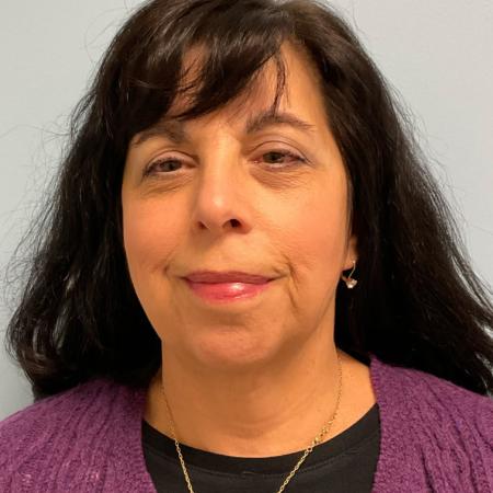 After image 3 Case #129811 - 66 y.o female with Face & Necklift w/ Fat Grafting