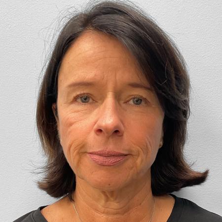 Before image 1 Case #133111 - Facelift & Laser Resurfacing