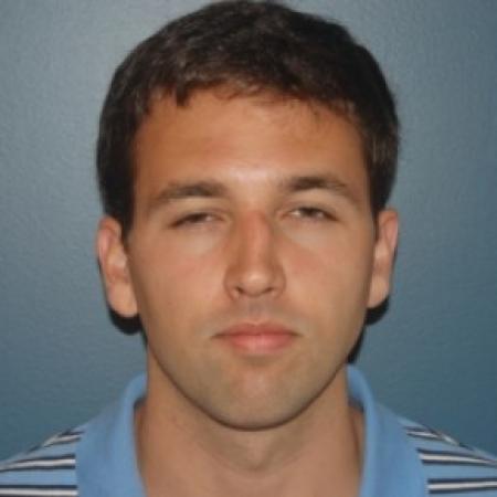 Before image 1 Case #81261 - Rhinoplasty