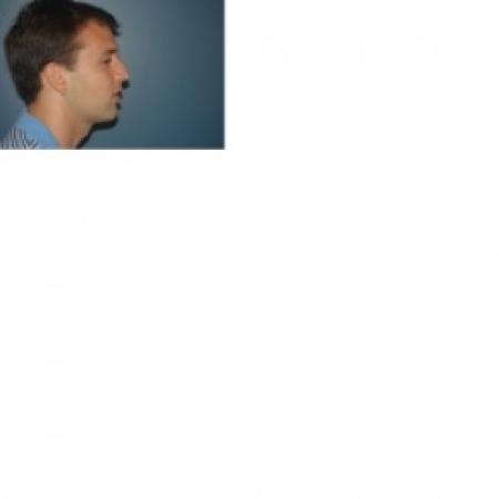 Before image 2 Case #81261 - Rhinoplasty