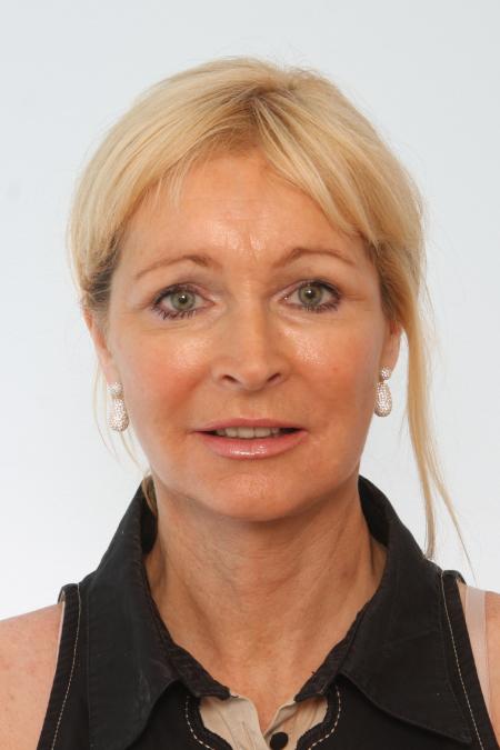 After image 1 Case #125856 - Facelift