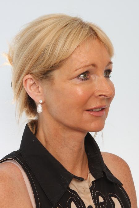 After image 2 Case #125856 - Facelift