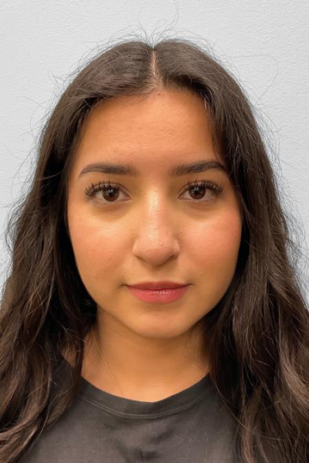 After image 1 Case #127656 - Rhinoplasty