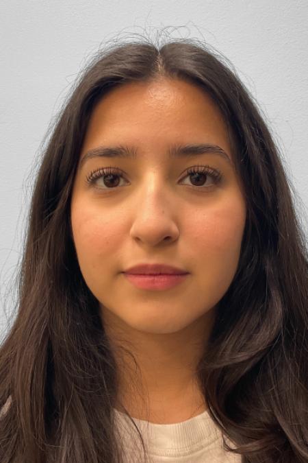 Before image 1 Case #127656 - Rhinoplasty