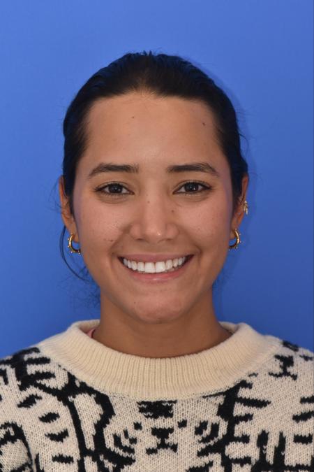 After image 6 Case #129946 - RHINOPLASTY