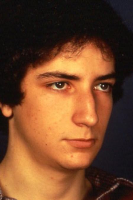 Before image 1 Case #81556 - Rhinoplasty