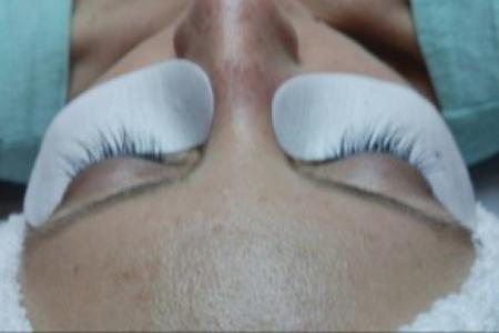 After Case #86386 - 38 year old woman treated with eyelash enhancement