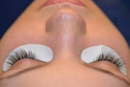 After image 1 Case #86371 - 25 year old woman treated with eyelash enhancement.