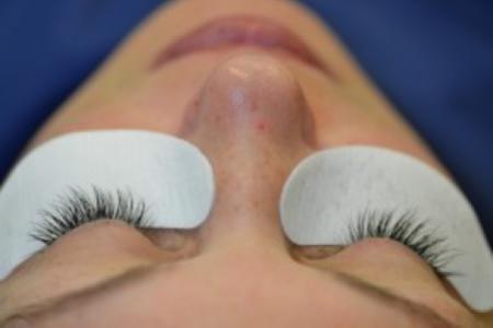 After image 1 Case #86366 - Eyelash enhancement