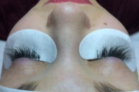 After Case #86396 - 26 year old woman treated with eyelash enhancement