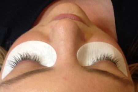 After Case #86381 - 35 year old woman treated with eyelash enhancement