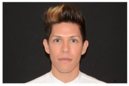 After image 1 Case #87111 - Non-Surgical Rhinoplasty