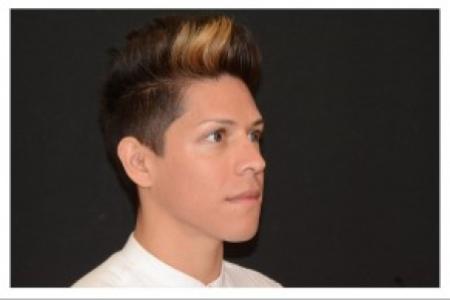 After image 2 Case #87106 - Non-Surgical Rhinoplasty
