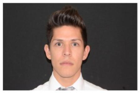 Before image 1 Case #87106 - Non-Surgical Rhinoplasty