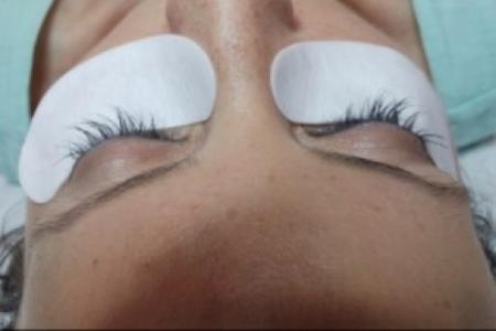 Before Case #86386 - 38 year old woman treated with eyelash enhancement