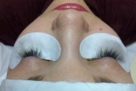Before Case #86396 - 26 year old woman treated with eyelash enhancement