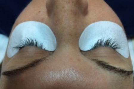 Before image 1 Case #86341 - 37 year old woman treated with eyelash enhancement