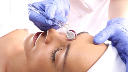 Woman undergoing Microneedling procedure