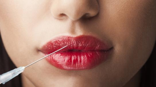 Woman receiving a lip filler injection