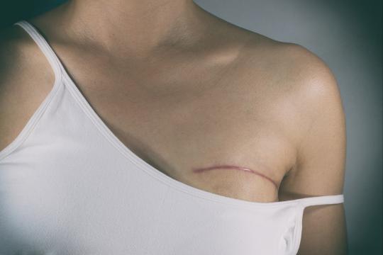 A woman's post surgical scar from plastic surgery